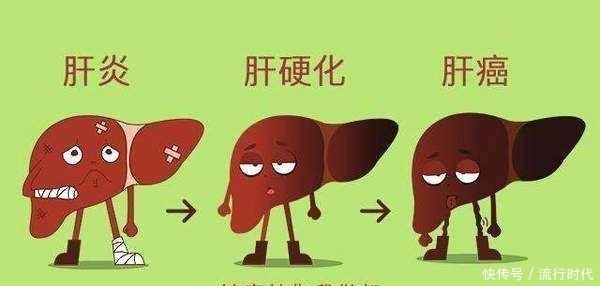抗病毒8年仍然肝硬化,乙肝大三阳变为13阳性