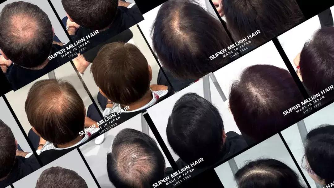 岛国这款生发神器，让你一言不合就长成热带雨林