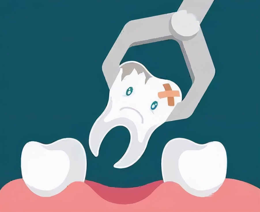 拔牙后担心干槽怎么办,拔牙后得干槽症该追究医院责任吗