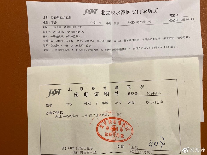 拔火罐被烧伤的明星,拔火罐明星烧伤