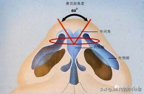 鼻子怎么修复好看呢,鼻型修复方法大全
