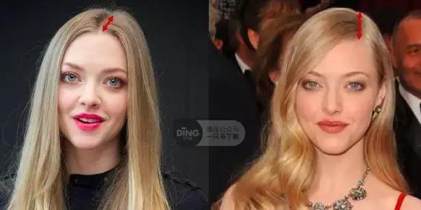 颅顶太低如何自救,颅顶低怎么自救