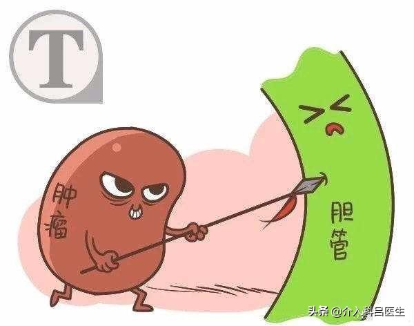 黄疸肝炎最佳治疗方法微创,黄疸最佳治疗方法微创