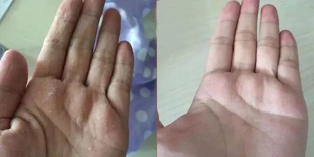 日本蜂王乳面霜,日本的霜好用不过敏干性皮肤用