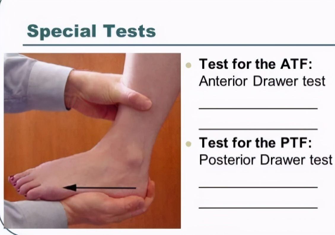 踝关节不稳定踝关节扭伤的后遗症,踝关节扭伤的人戴护踝有作用吗
