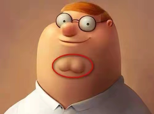 皮肤长肉疙瘩、脂肪瘤？4味中药，一消一补，标本兼顾