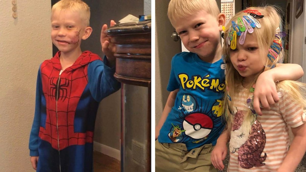 真英雄！6岁男孩为救妹妹被狗咬伤，“复仇者”送来了最棒的礼物