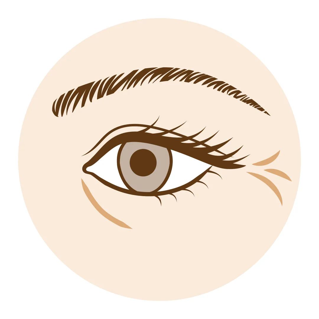 有效去除眼纹眼霜,眼纹可以通过医美什么方式治疗