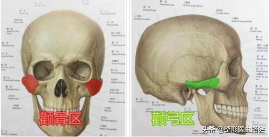 颧骨高真的能通过手法改善吗,颧骨高怎么样才可以改善