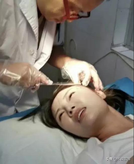 徐冬冬拍戏受伤的原因,徐冬冬自曝曾患抑郁症