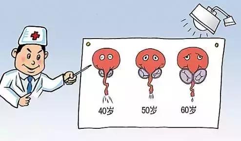 怀疑自己前列腺要做什么检查,确诊前列腺需要查什么