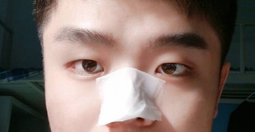 超微小气泡毛孔吸尘器男生能用吗,超微小气泡毛孔吸尘器好不好