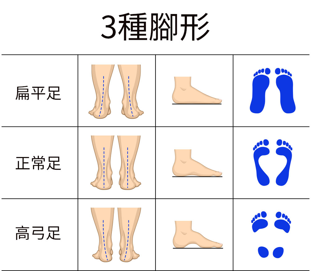 深蹲膝盖不超过脚尖就向后倒,深蹲可以改善膝盖内扣吗