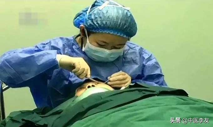 医生需要掌握：针灸治病容易导致的8种异常情况