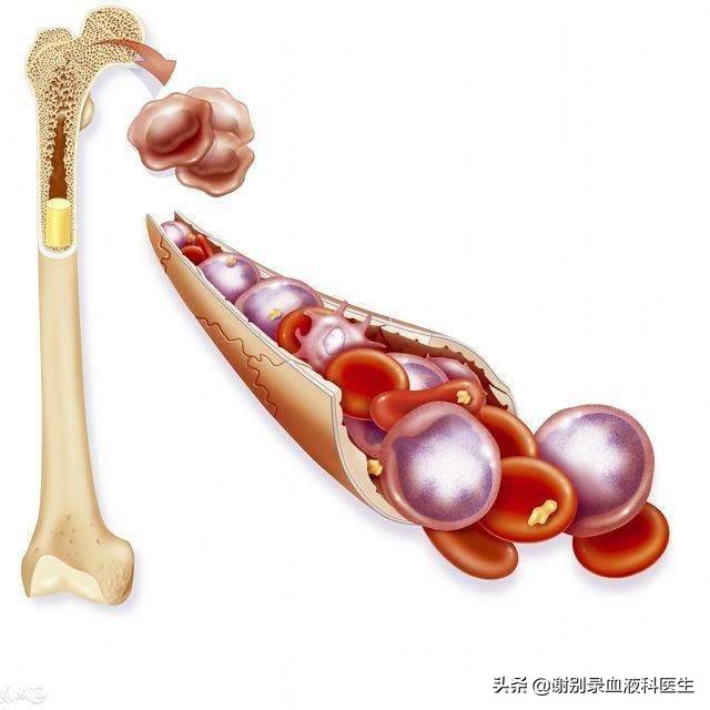 骨髓移植能完全恢复吗,骨髓移植能痊愈吗