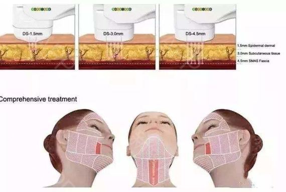鑰佺帇闈㈤儴鍙樼編,鑰佺帇鏁欎綘鍙樼編