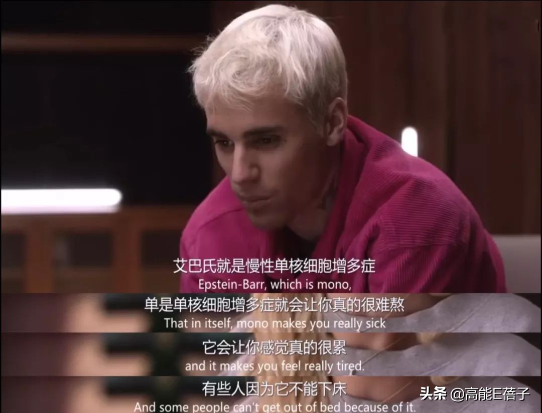 贾斯汀比伯浪了一圈归来还是少年,贾斯汀比伯晒自曝右脸面瘫