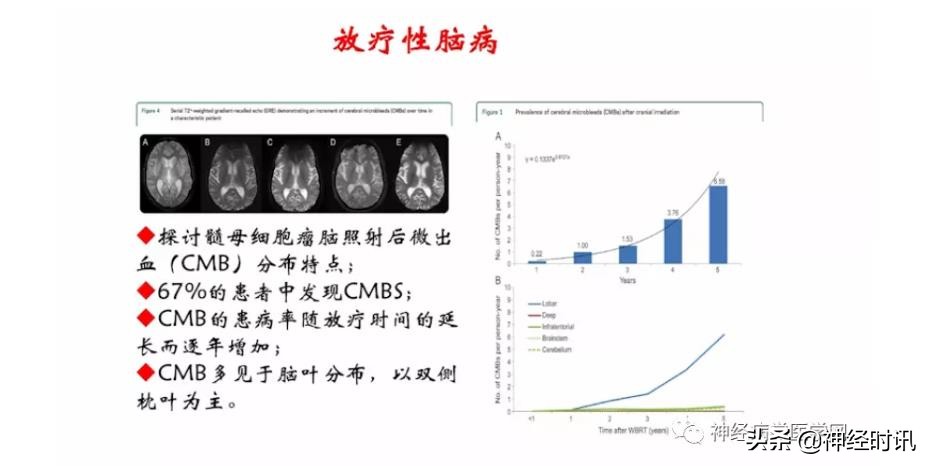 缺血性脑血管病出血评估,脑血管微出血怎么治疗