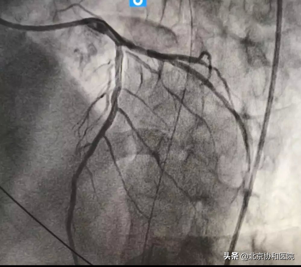 荆州95后护士救人,90后护士路边救人