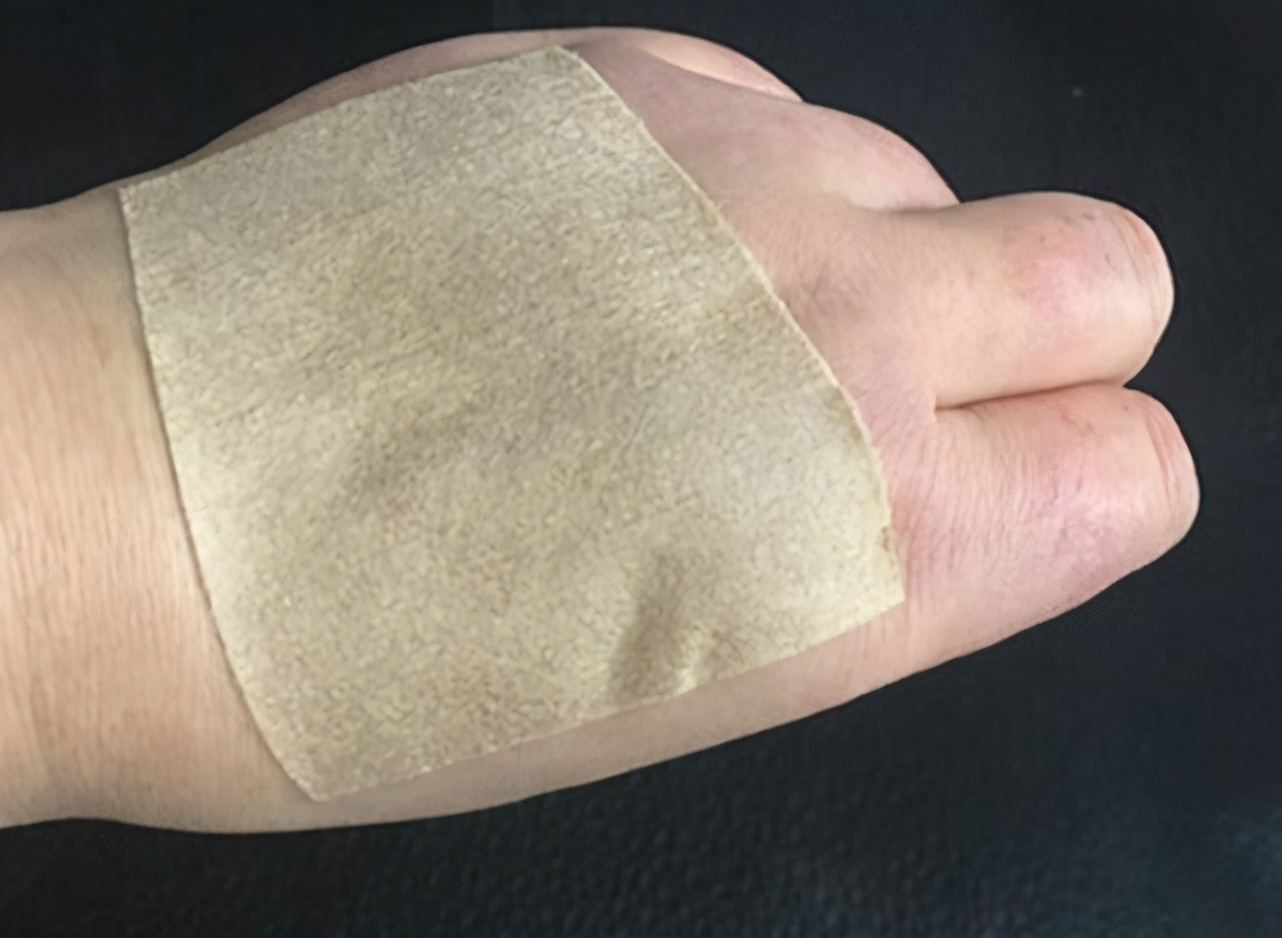 热天手上长汗疱疹怎么回事,天气热身上起汗疱疹