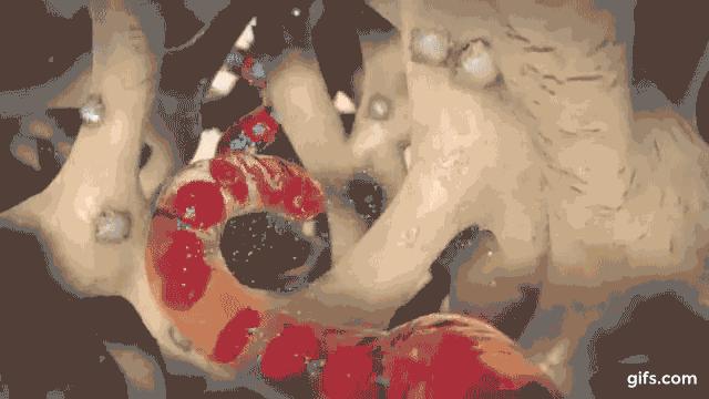 慢性肾病透析后肾还能恢复吗,慢性肾功能衰竭尿毒症透析