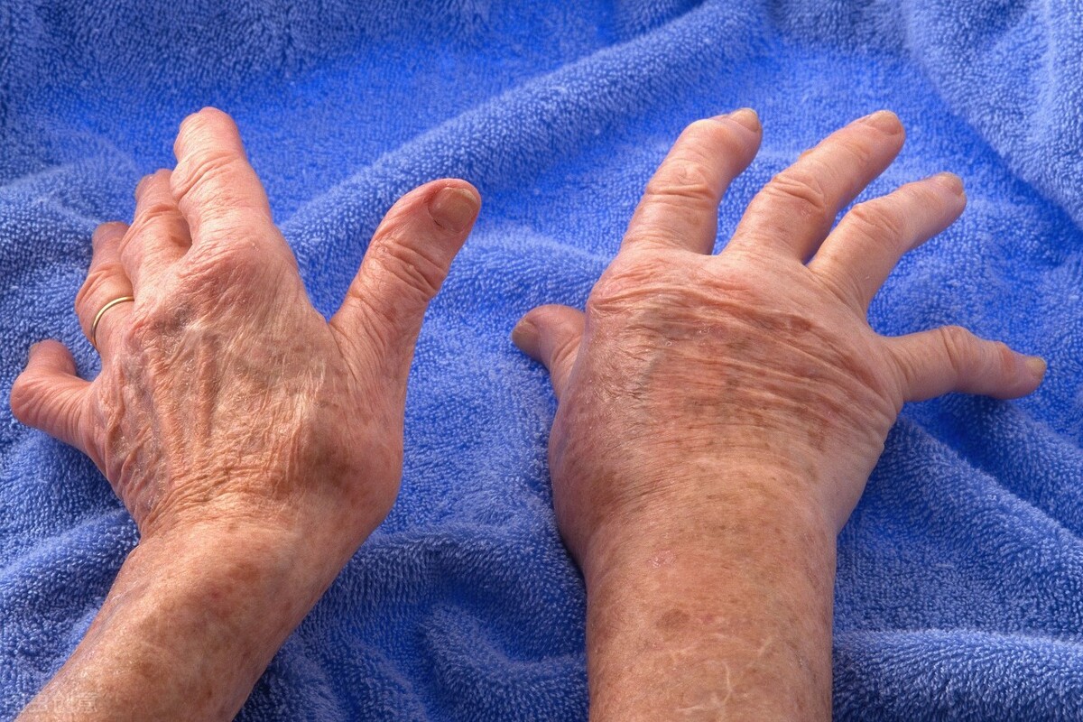 风湿关节痛最好的治疗方法,冷了膝盖疼吃什么药