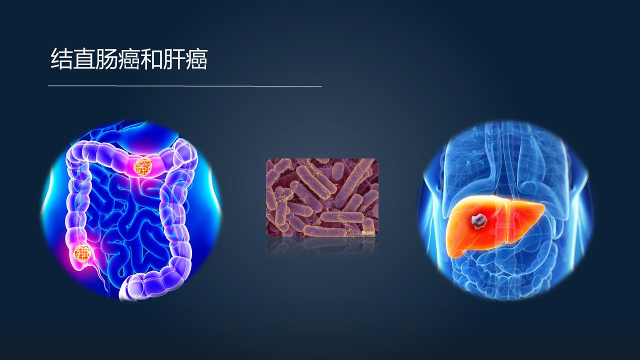 「图文实录」郑晓皎：18分钟详解菌群-胆汁酸与消化系统肿瘤