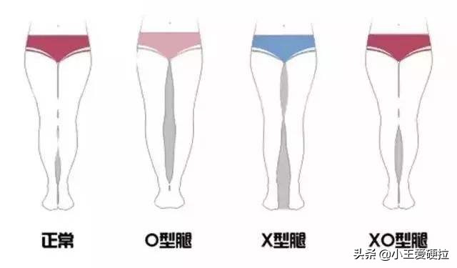 深蹲训练膝关节疼痛？需要进行充分热身和强化小腿深层肌群