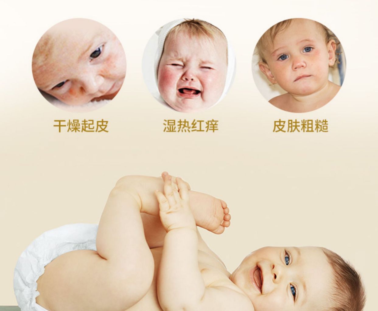 宝宝皮肤干燥怎么办才好,宝宝皮肤干燥怎么办快速解决