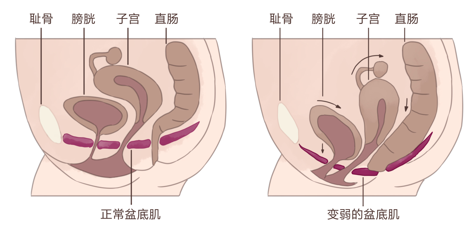 产后恢复身材的最快方法,产后如何坐好月子快速恢复身材