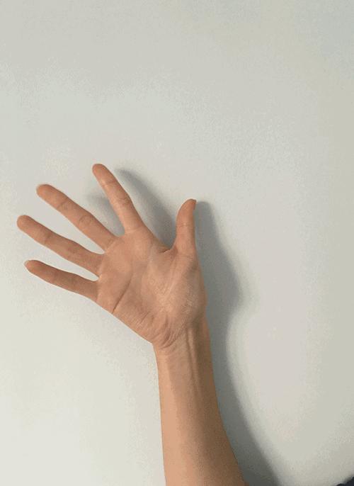 腱鞘炎3次治愈,腱鞘炎在三甲医院挂什么科