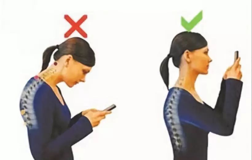 每天玩手机超过9小时,玩手机导致的颈椎病如何能治愈