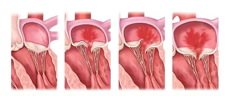 心脏使用说明及保养,心脏用药记忆口诀
