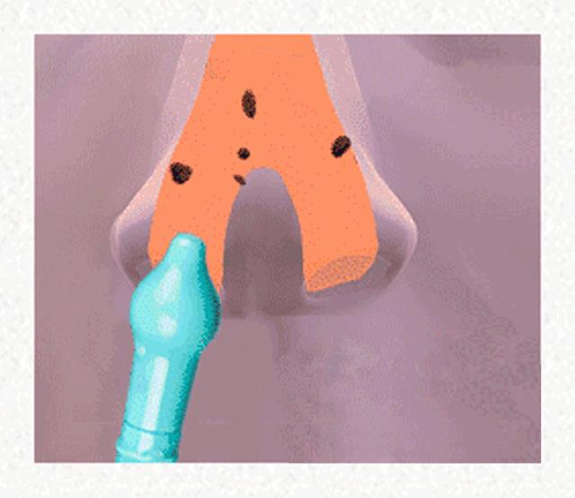 2个常见的儿童用药误区家长必看,家里常备这8种药孩子生病不慌乱