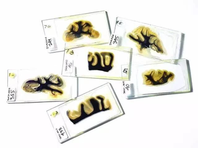 爱因斯坦的大脑vs正常人的大脑,爱因斯坦的大脑和人类的大脑