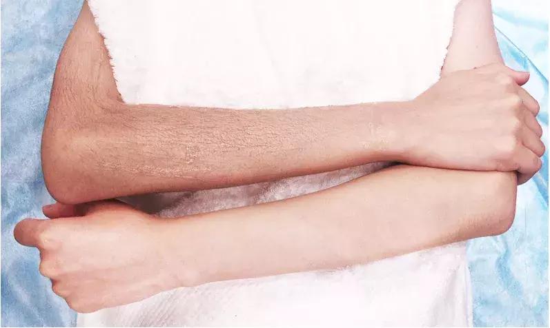 现在什么美容项目最赚钱最火,美容最挣钱的仪器