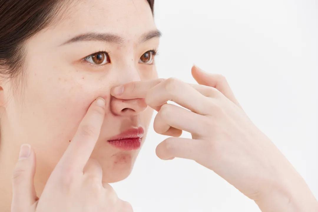 护肤皮肤干,皮肤补水就会长痘怎么办