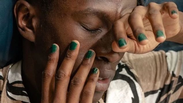 男生想变帅除了整容怎么办,男生想整容正常吗