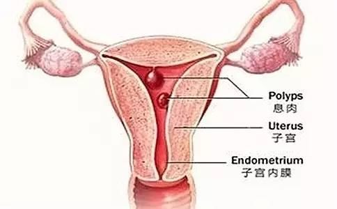 子宫异常出血和大姨妈的区别,判断子宫异常出血最简单的方法