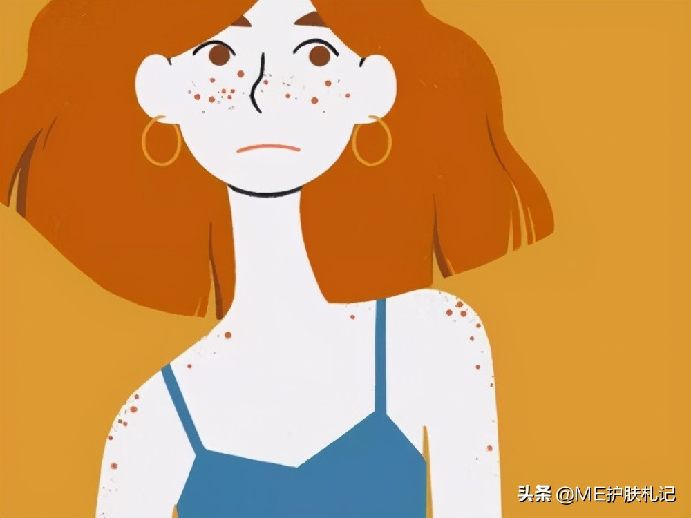 薇绮美胶原蛋白淡化色斑,ME胶原蛋白肽怎么样