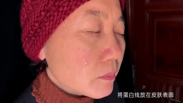 瞬间祛皱纹产品真的有用吗,黄金提拉线雕效果怎么样