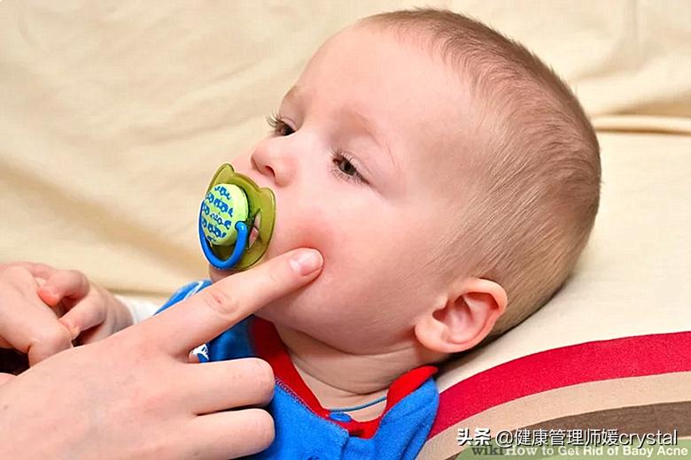 婴儿皮肤科湿疹,宝宝湿疹8个谣言