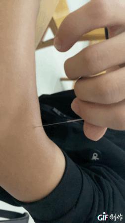 飞经走气手法视频,飞经走气针灸手法