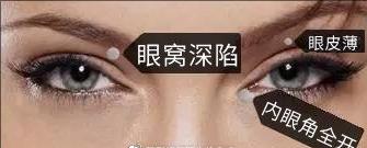 欧式双眼皮好看吗真的适合你吗,纯天然欧式双眼皮