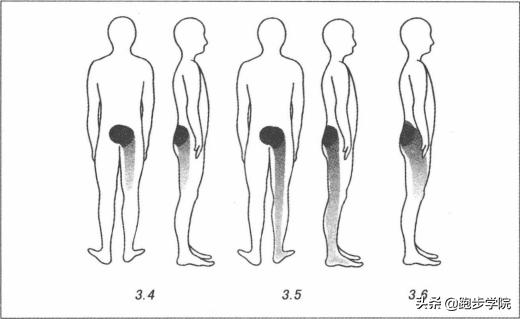 腰椎间盘突出跑步好还是跳绳好,腰椎间盘4-5节突出可以跑步吗