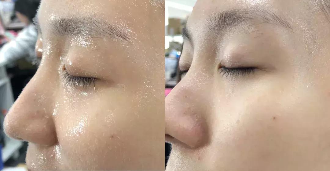 有了前法国第一夫人的百元“黑科技”眼霜,我把3000块眼霜扔了!