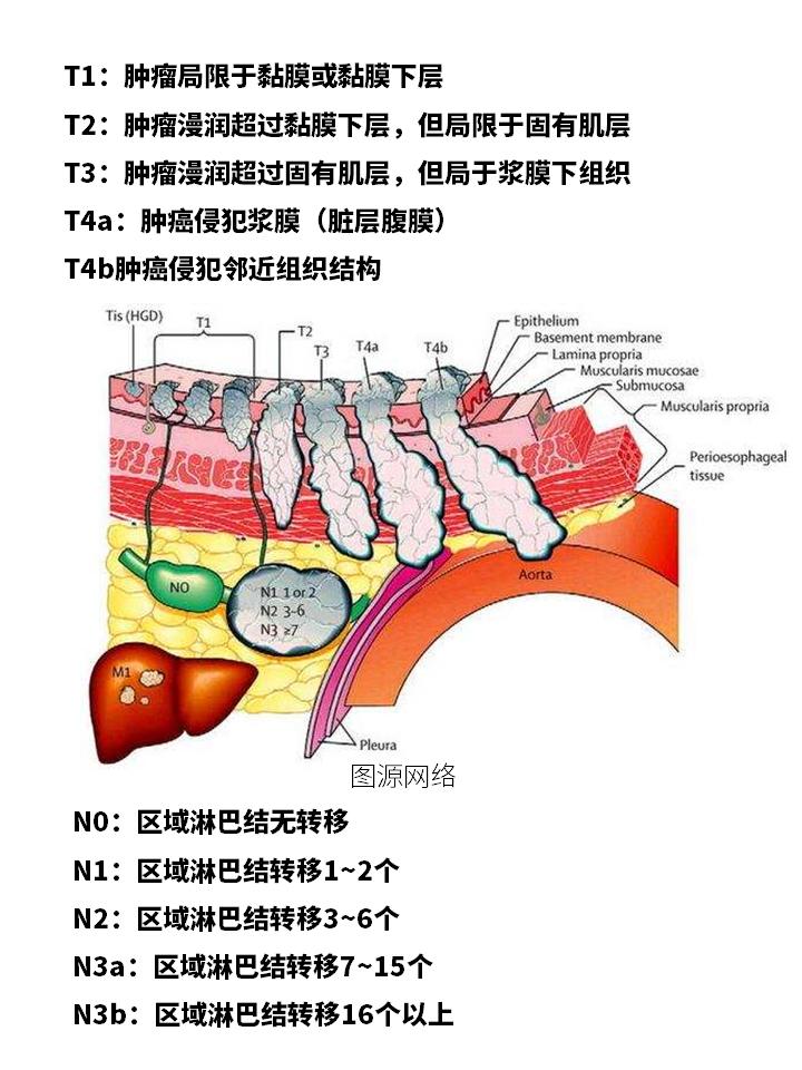 老年人肠癌要不要开刀,肠癌需不需要做靶向治疗
