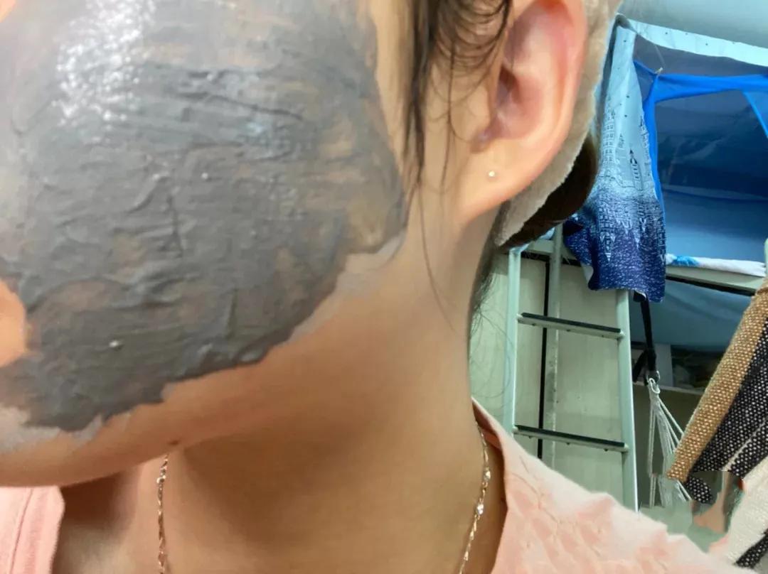 甲硝唑凝胶的使用方法祛黑头,祛黑头最好的方法目前最有效