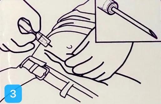 打皮下针拔针出血怎么办,皮下注射有回血继续注射会死吗