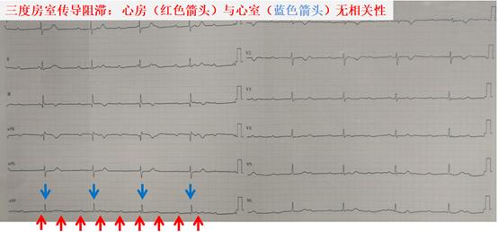 急诊手术后32岁的新妈妈对我说“医生，一点不痛，很享受”